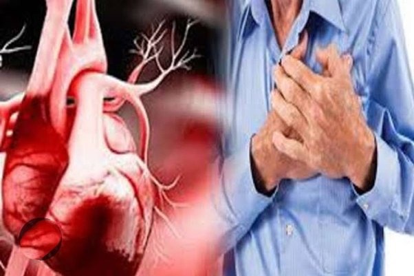 7 फल (Fruits) जो कोलेस्ट्रॉल (Cholesterol) से बंद नसों को खोलेंगे, हार्ट अटैक (Heart Attack)का खतरा होगा कम